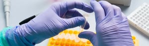 Laborfachkraft bereitet Proben für die In-vitro-Diagnostik (IVD) im Labor unter den Anforderungen der IVDR vor.