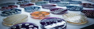 Mikrobiologische Untersuchung von Bioburden und Endotoxinen in Petrischalen zur Bewertung der biologischen Sicherheit von Medizinprodukten.