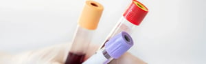 Blutprobenröhrchen in einer Laborhand als Symbol für die Leistungsbewertung, klinische Leistung und regulatorische Anforderungen von In-vitro-Diagnostika (IVD) nach IVDR.